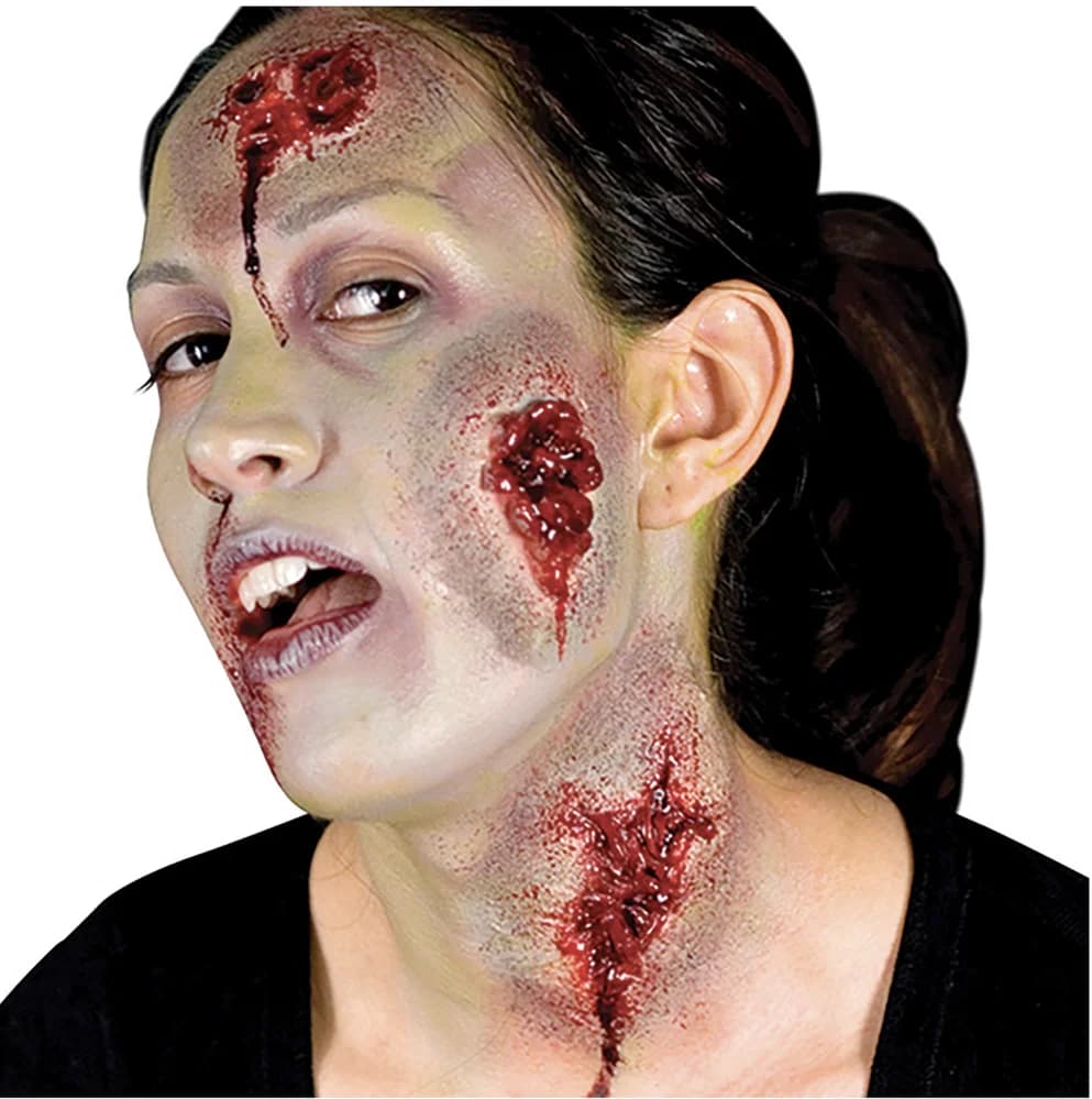 Oozing Wounds