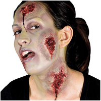 Oozing Wounds